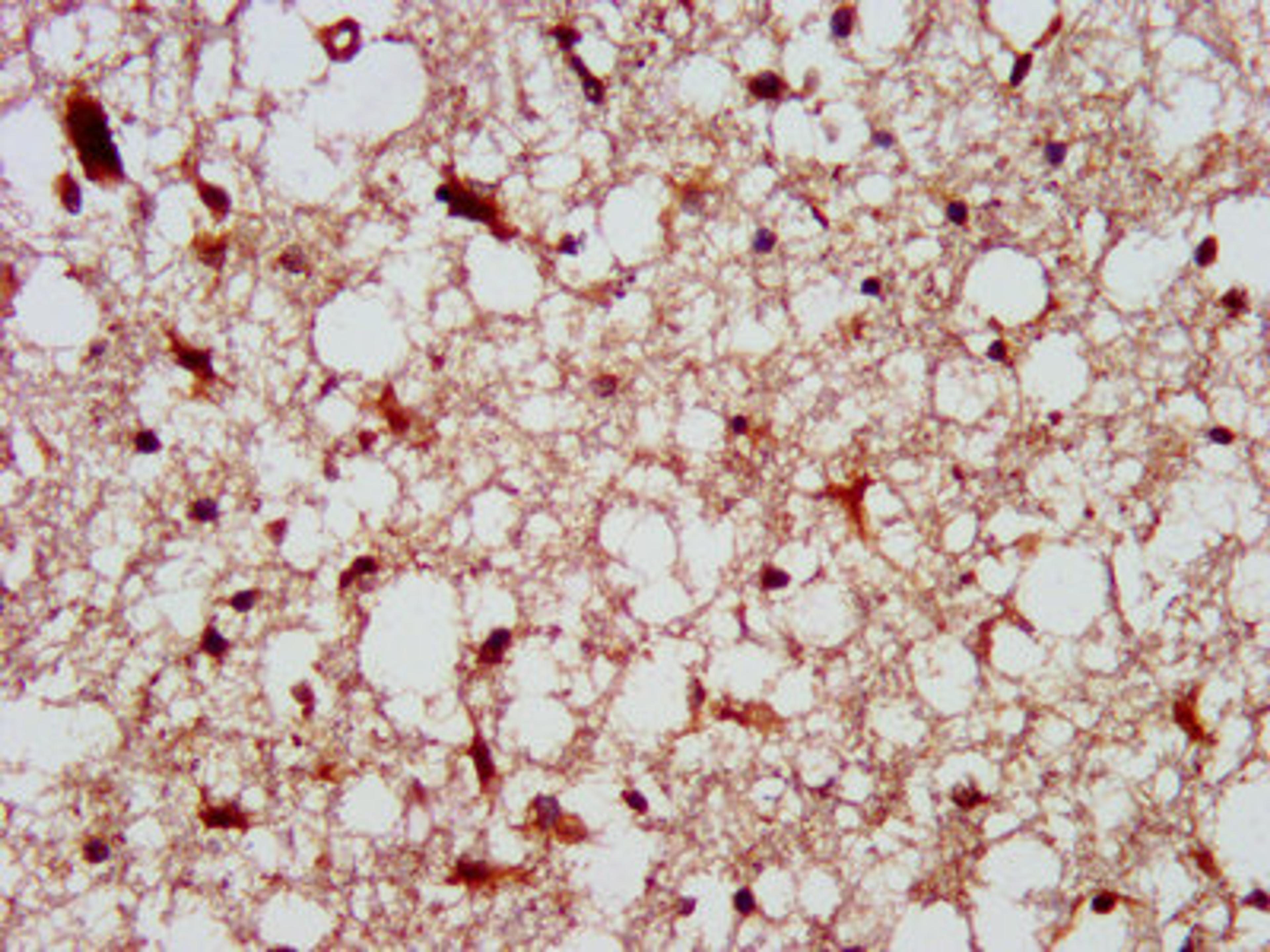 IHC image of CSB-PA614263LA01HU diluted at 1:300 and staining in paraffin-embedded human brain tissue performed on a Leica BondTM system. After dewaxing and hydration, antigen retrieval was mediated by high pressure in a citrate buffer (pH 6.0). Section was blocked with 10% normal goat serum 30min at RT. Then primary antibody (1% BSA) was incubated at 4°C overnight. The primary is detected by a biotinylated secondary antibody and visualized using an HRP conjugated SP system.