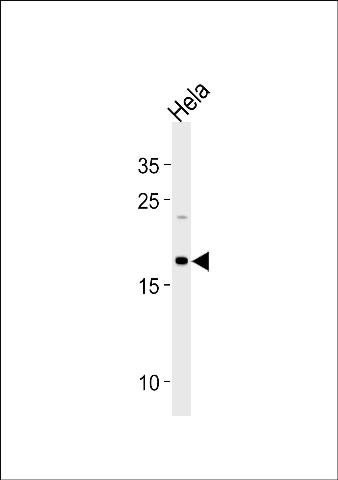 Western blot analysis in Hela cell line lysates (35ug/lane).