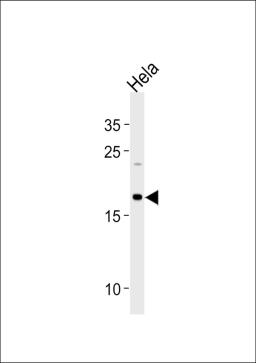 Western blot analysis in Hela cell line lysates (35ug/lane).