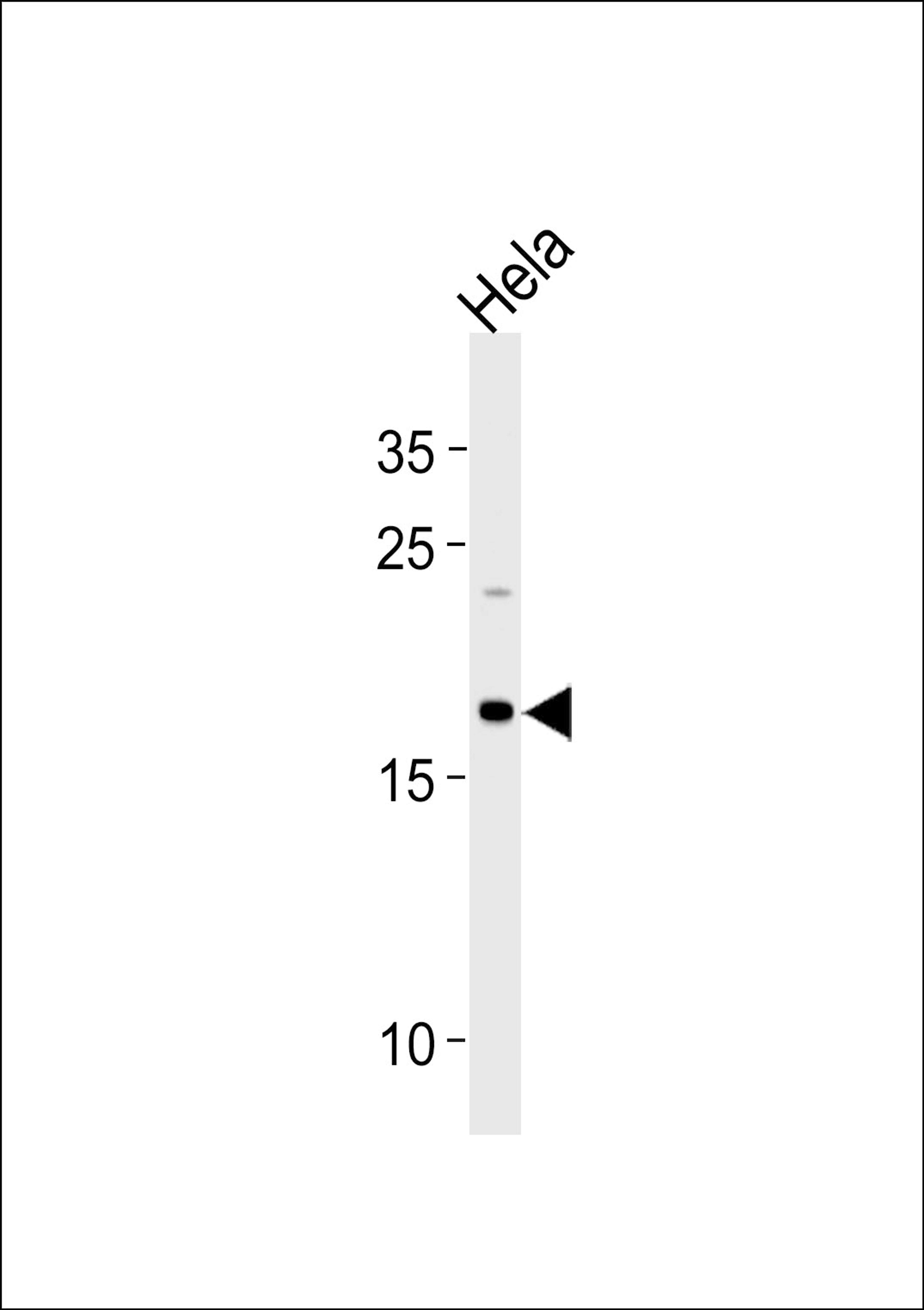 Western blot analysis in Hela cell line lysates (35ug/lane).