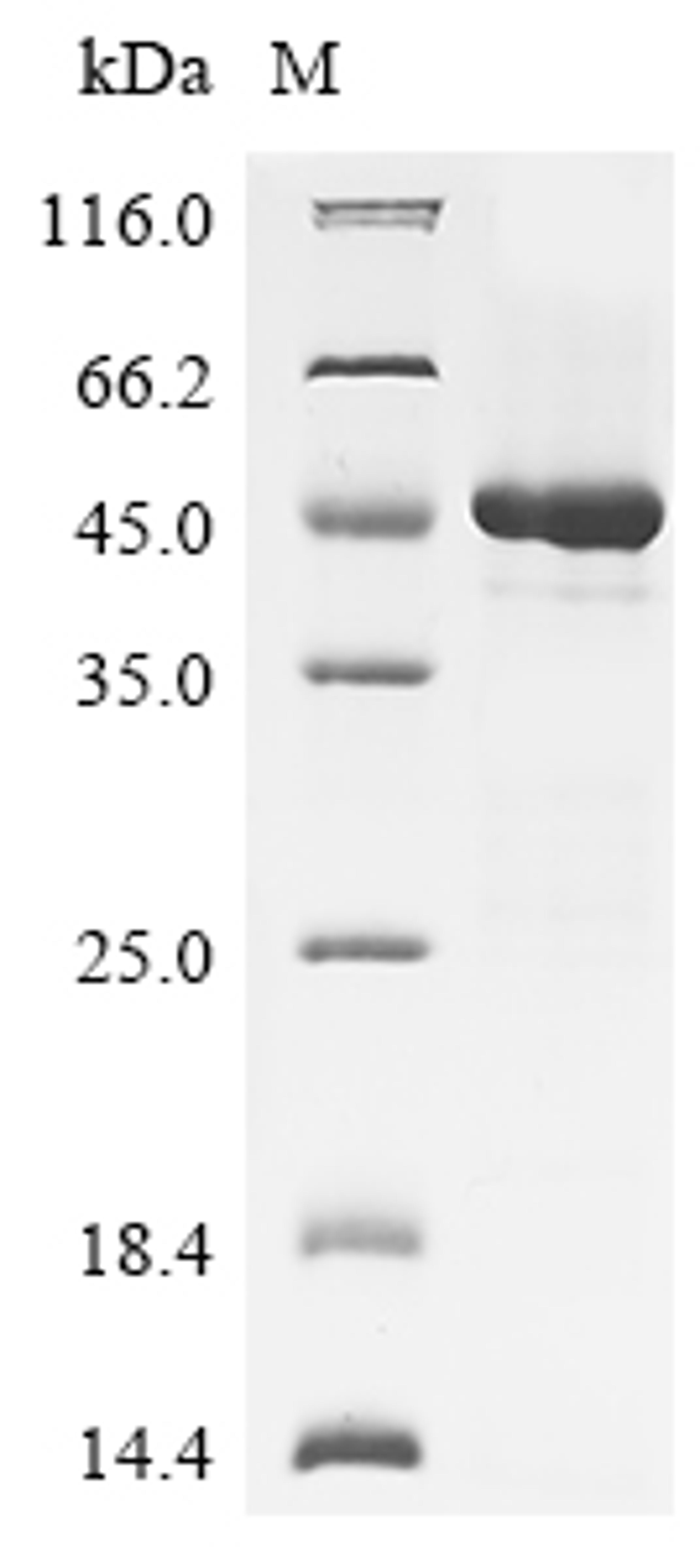 (Tris-Glycine gel) Discontinuous SDS-PAGE (reduced) with 5% enrichment gel and 15% separation gel.