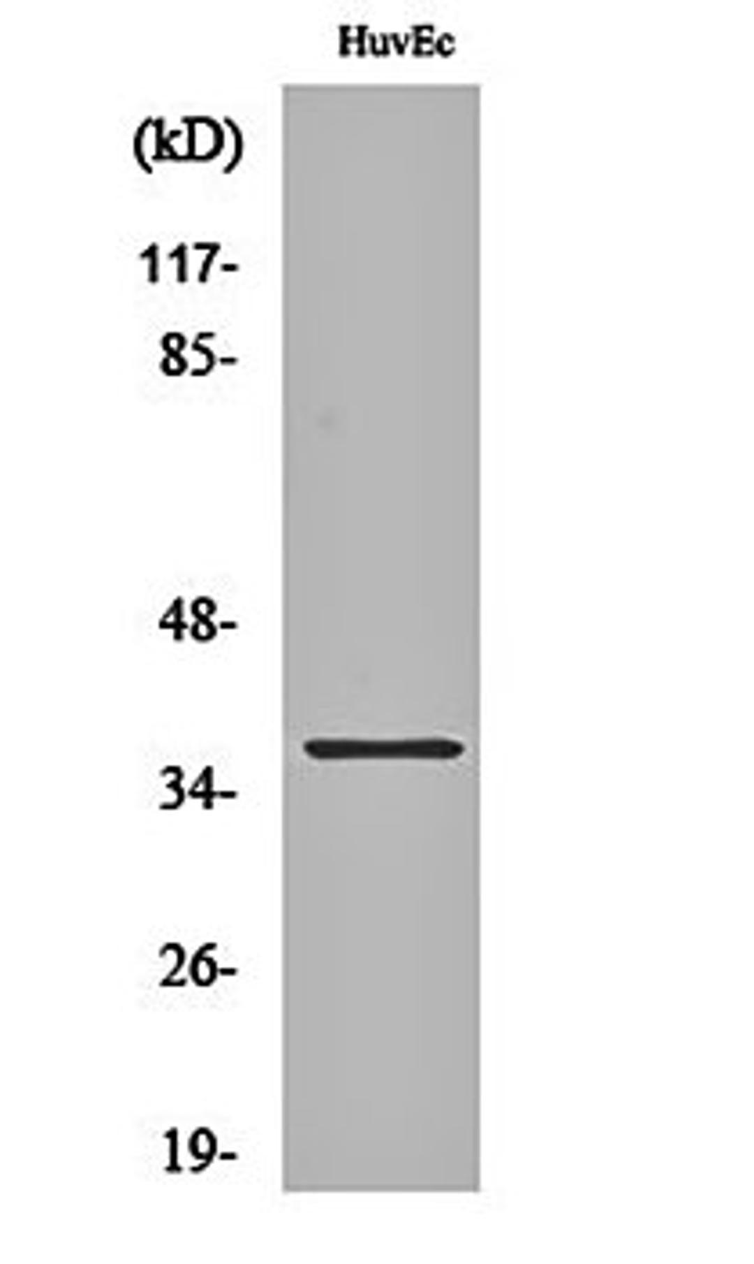 Western blot analysis of HuvEc cell lysates using Aldose Reductase antibody