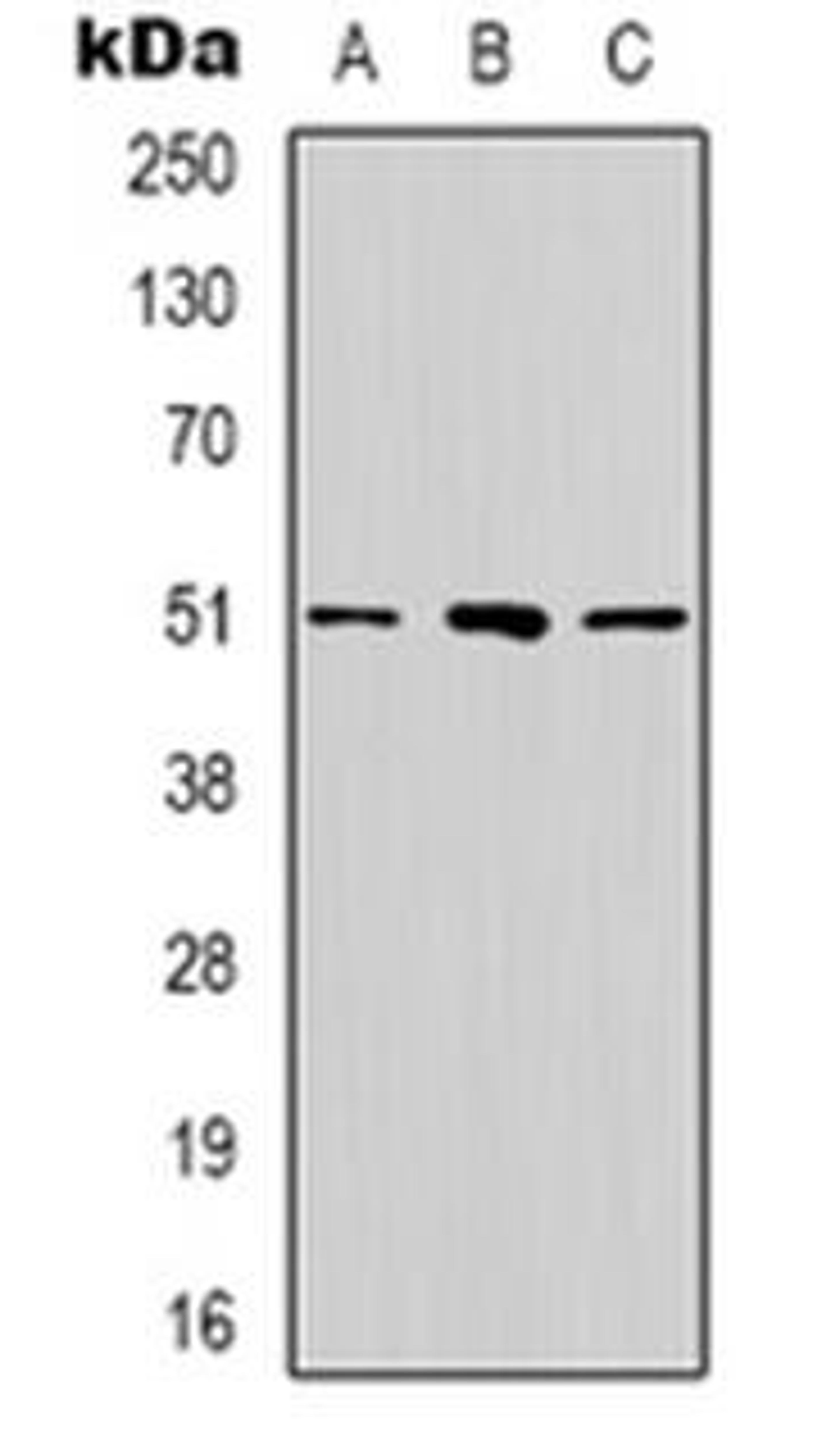 Western blot analysis of RRP8 expression in Hela (Lane 1), MCF7 (Lane 2), Hela (Lane 3) whole cell lysates using RRP8 antibody