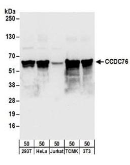 Detection of human and mouse CCDC76 by western blot.