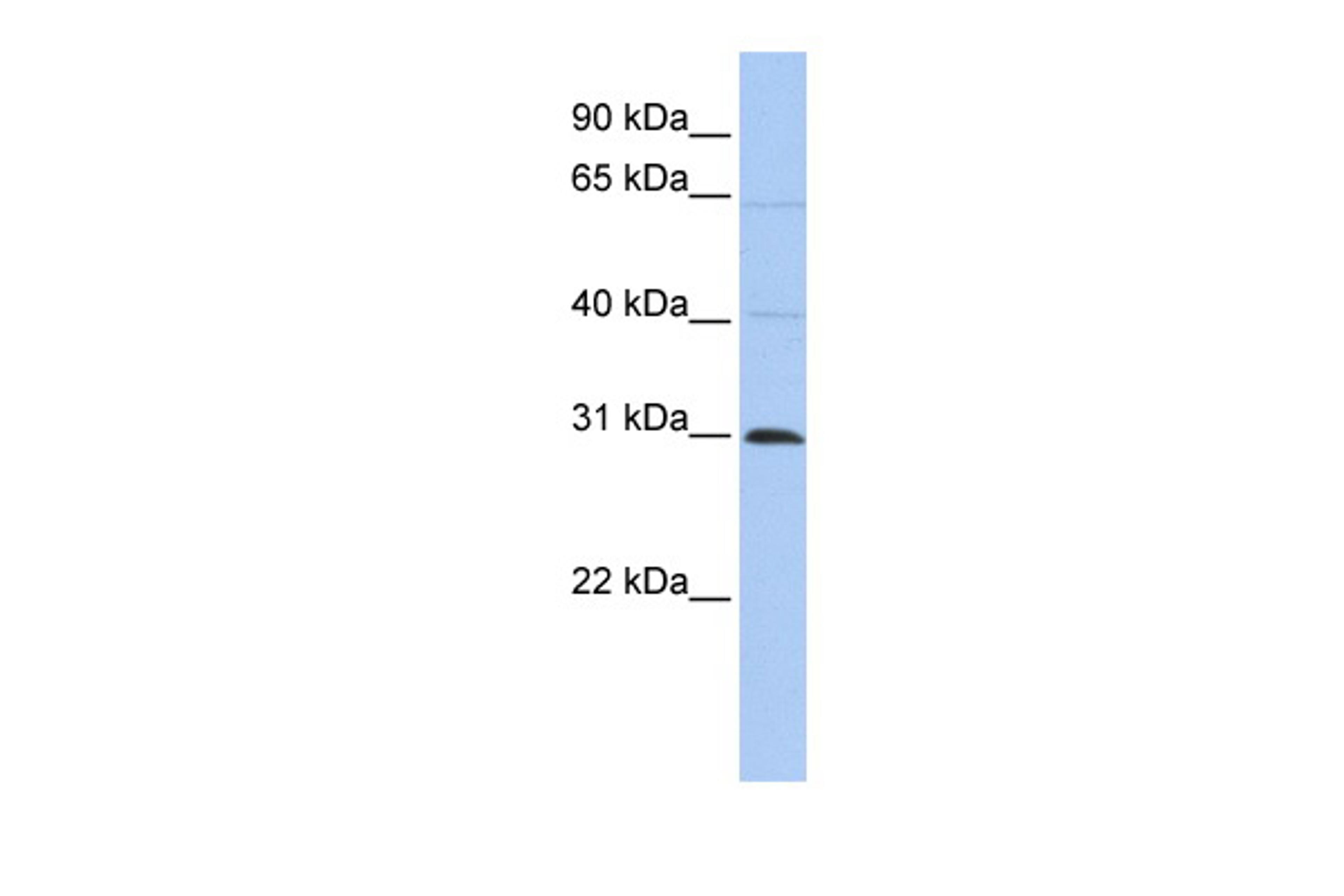 Antibody used in WB on Human HepG2 at 0.2-1 ug/ml.