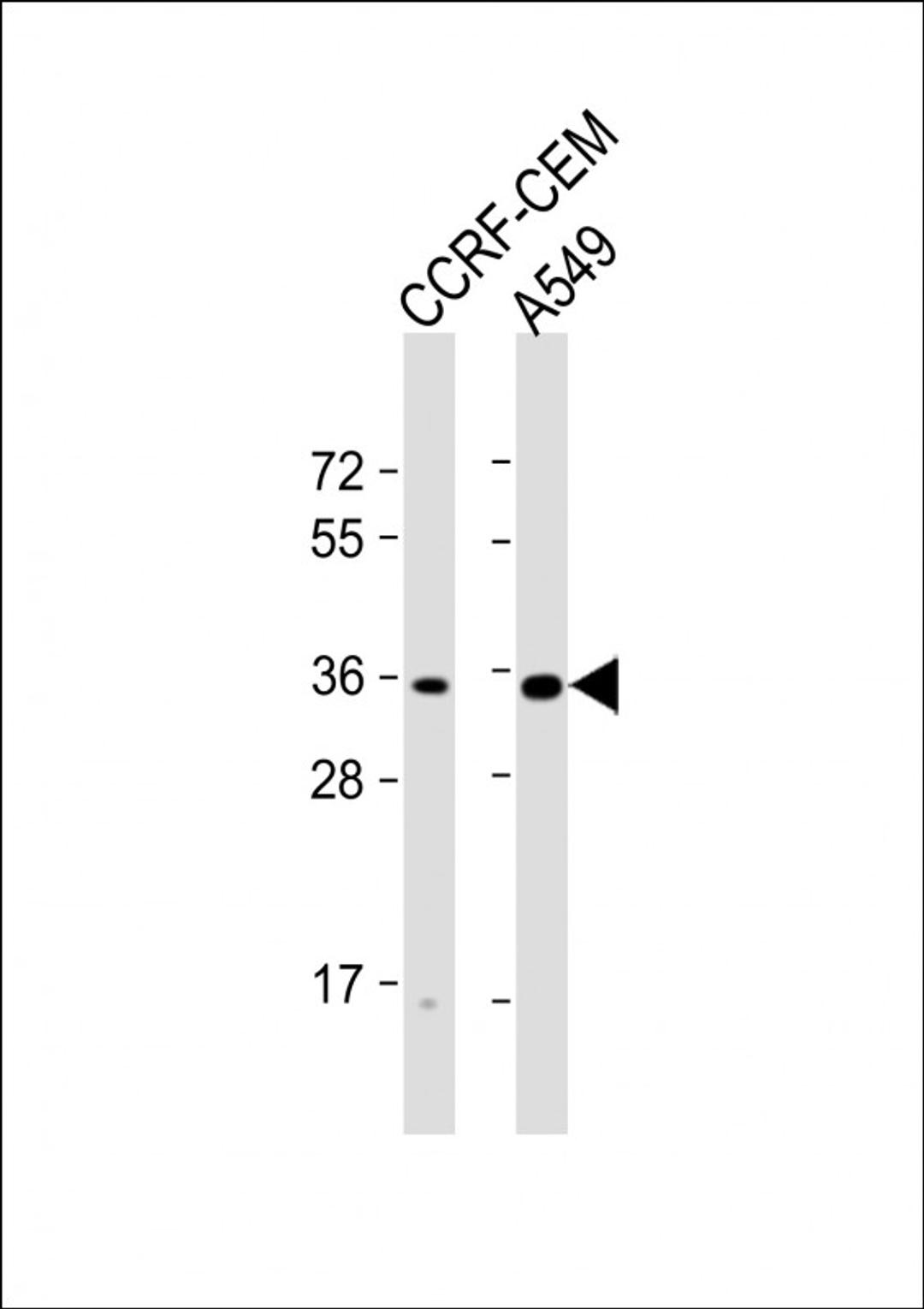 Western Blot at 1:1000 dilution Lane 1: CCRF-CEM whole cell lysate Lane 2: A549 whole cell lysate Lysates/proteins at 20 ug per lane.