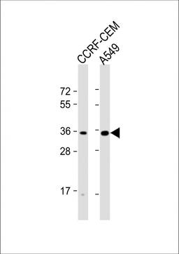 Western Blot at 1:1000 dilution Lane 1: CCRF-CEM whole cell lysate Lane 2: A549 whole cell lysate Lysates/proteins at 20 ug per lane.