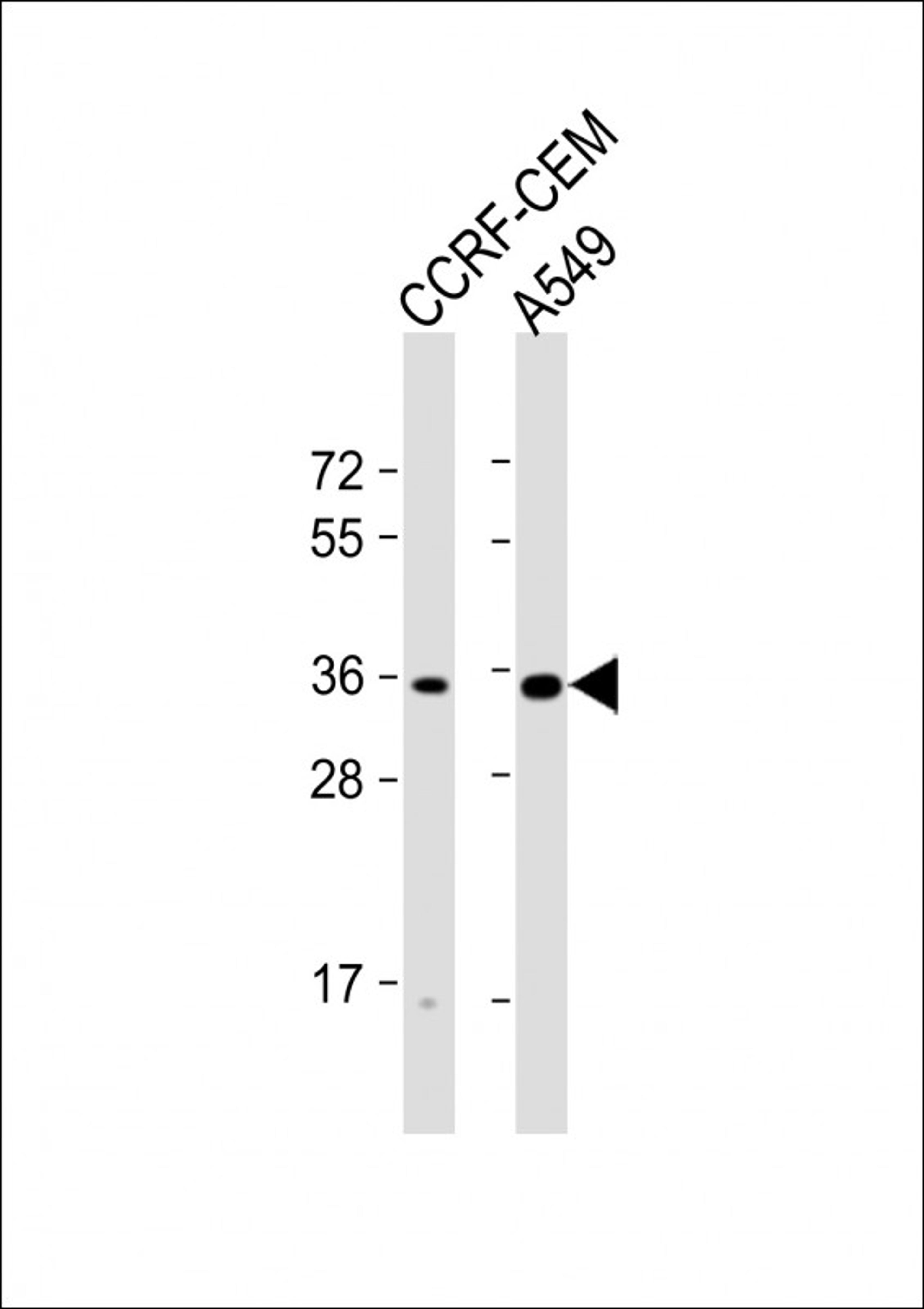 Western Blot at 1:1000 dilution Lane 1: CCRF-CEM whole cell lysate Lane 2: A549 whole cell lysate Lysates/proteins at 20 ug per lane.