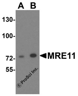 Western blot analysis of MRE11 in A549 cell lysate with MRE11 antibody at (A) 1 and (B) 2 &#956;g/mL.