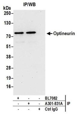 Detection of human Optineurin by western blot of immunoprecipitates.