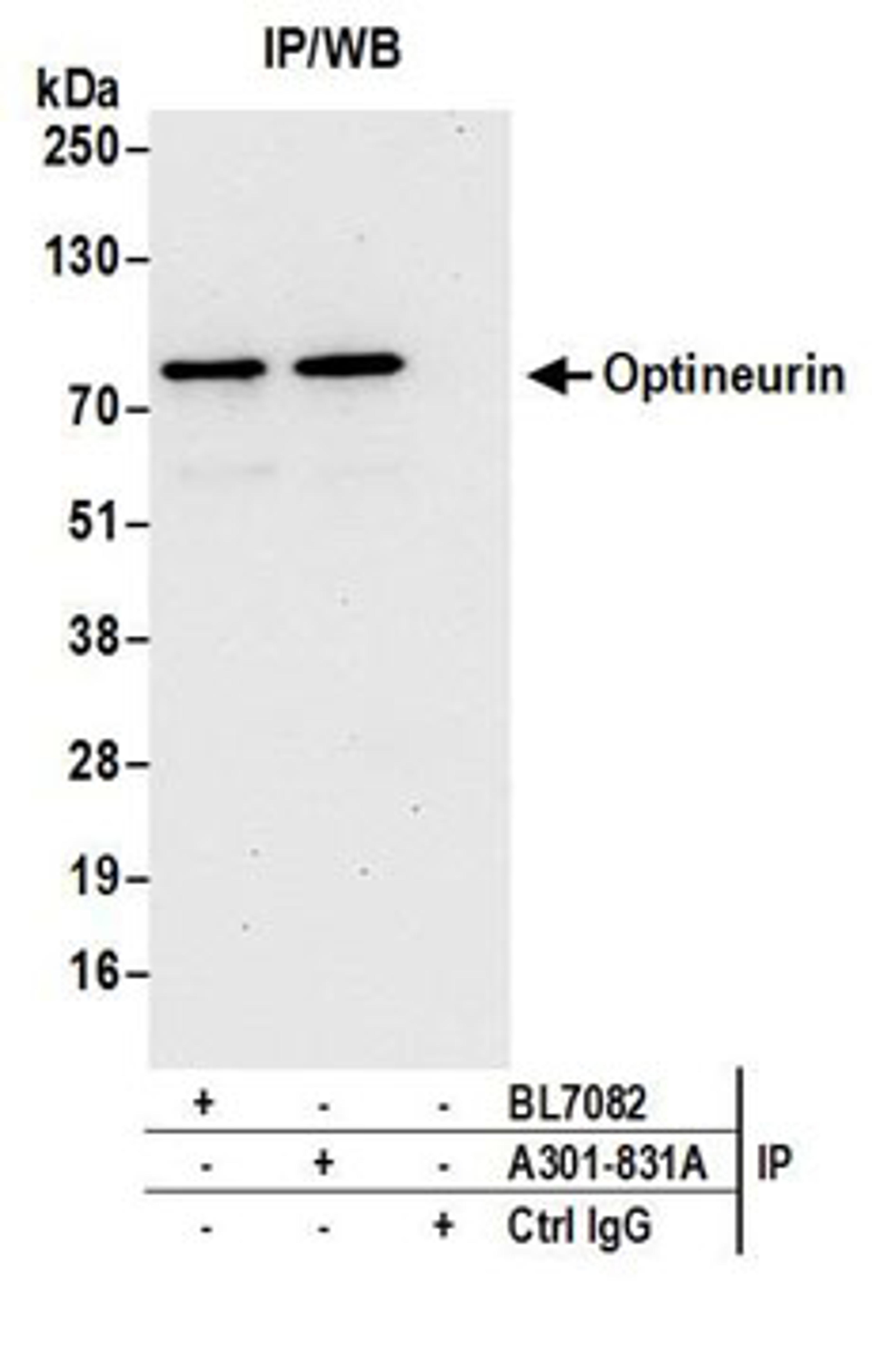 Detection of human Optineurin by western blot of immunoprecipitates.