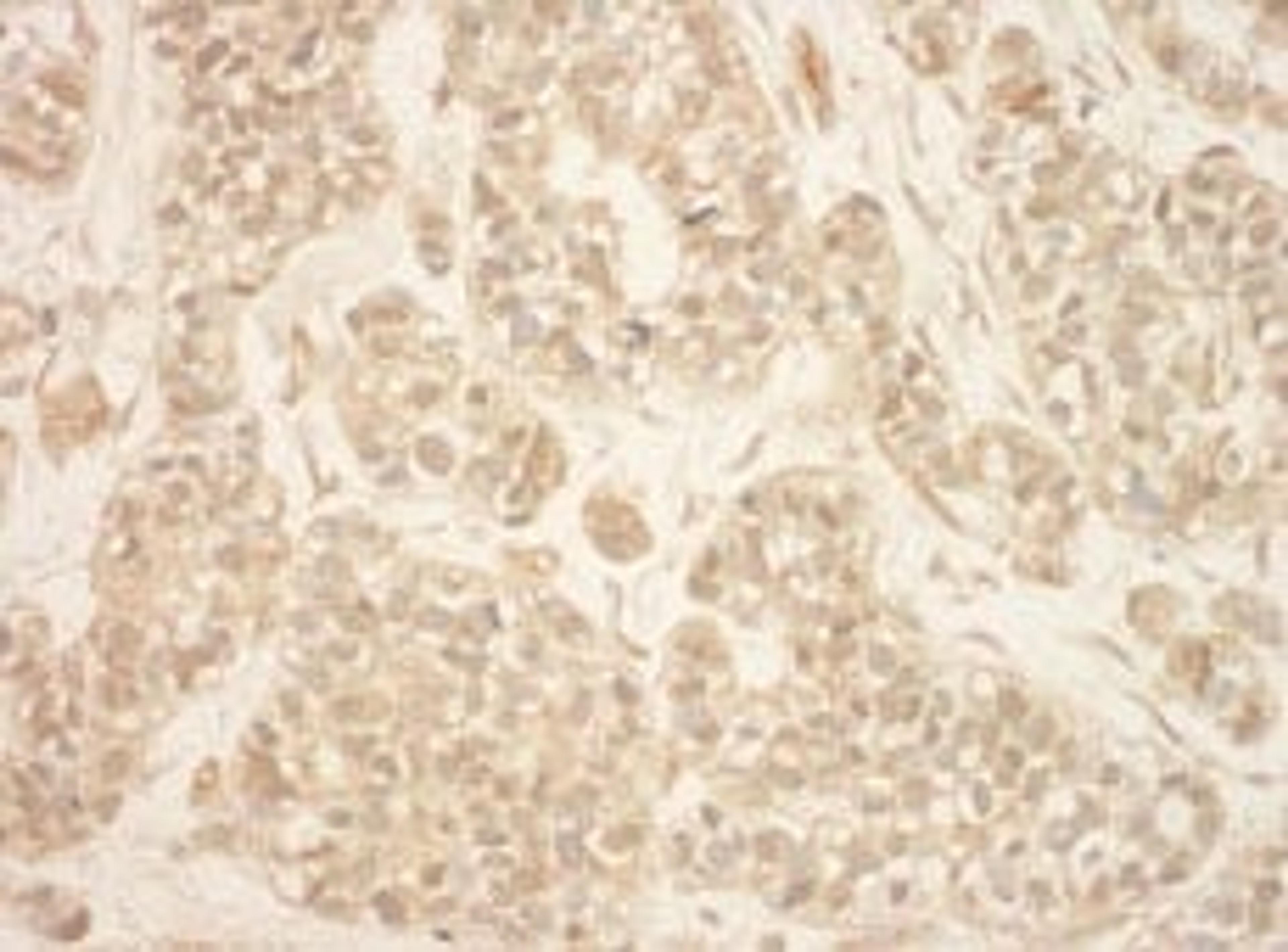 Detection of human RSK2 by immunohistochemistry.