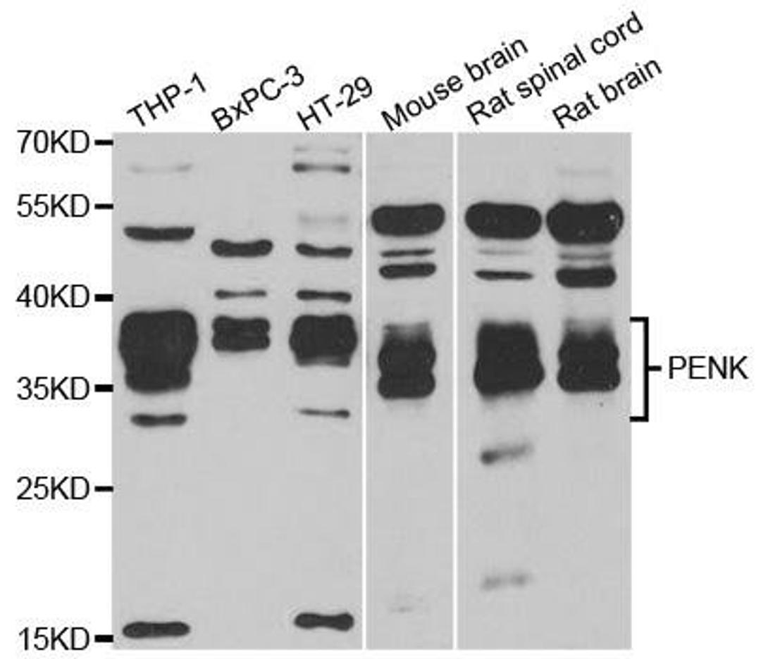 Western blot analysis of extracts of various cell lines using PENK antibody