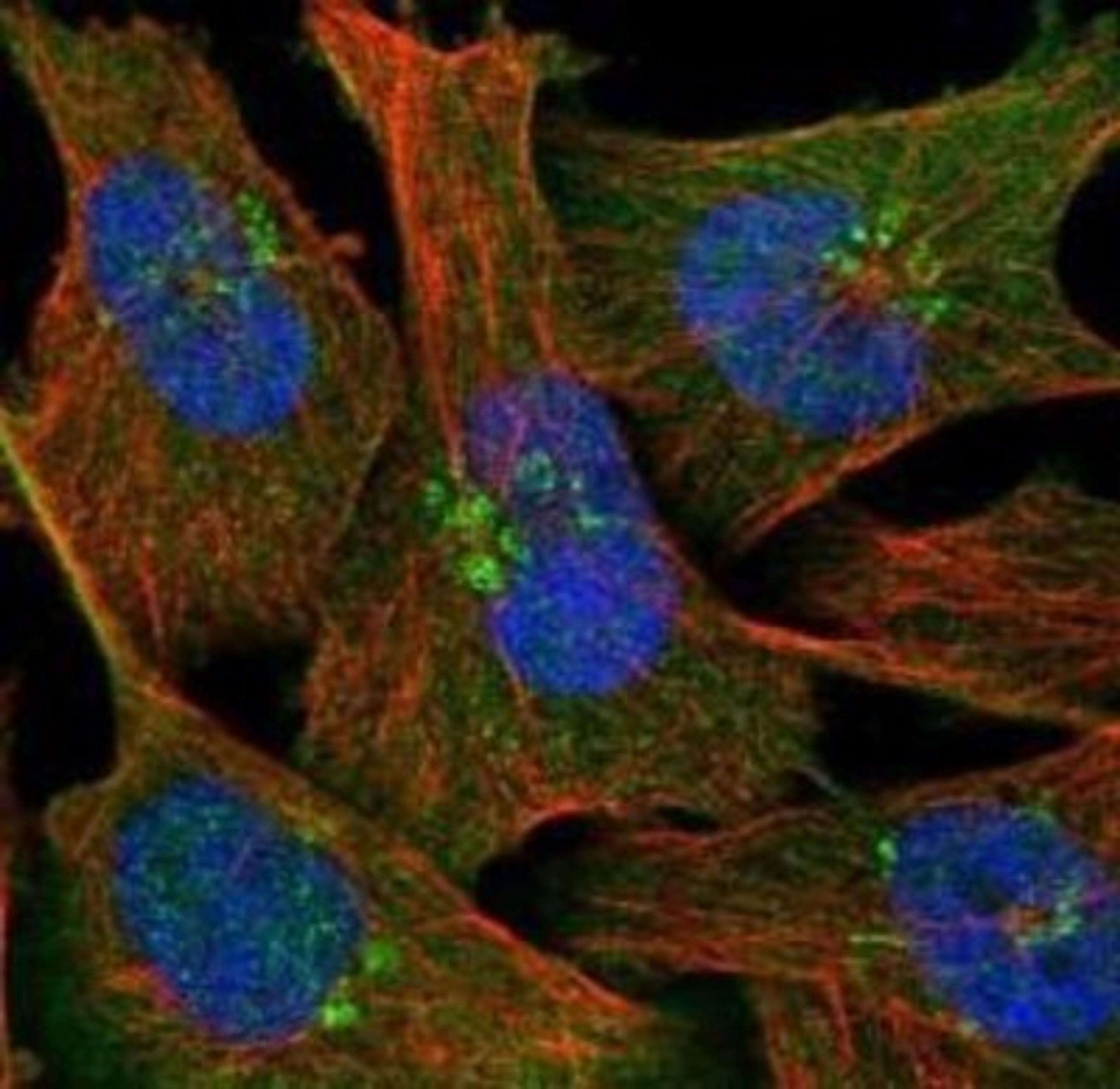 Immunocytochemistry/Immunofluorescence: NAPRT1 Antibody [NBP1-87243] - Immunofluorescent staining of human cell line U-251MG shows positivity in nucleus but not nucleoli, cytoplasm & golgi apparatus.