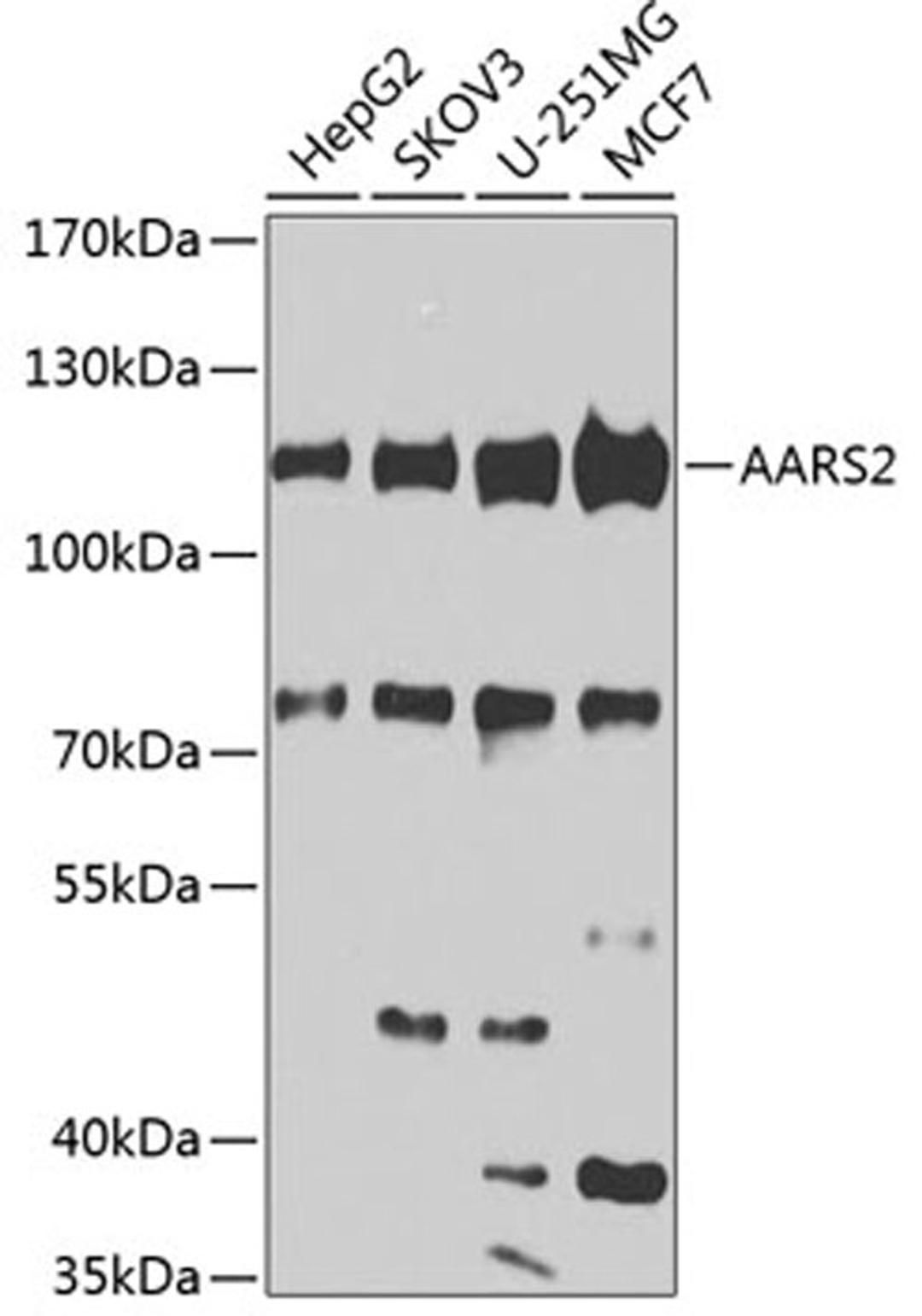 Western blot - AARS2 antibody (A7826)