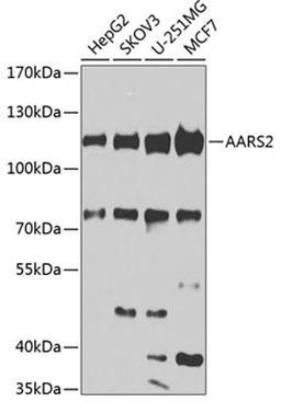 Western blot - AARS2 antibody (A7826)