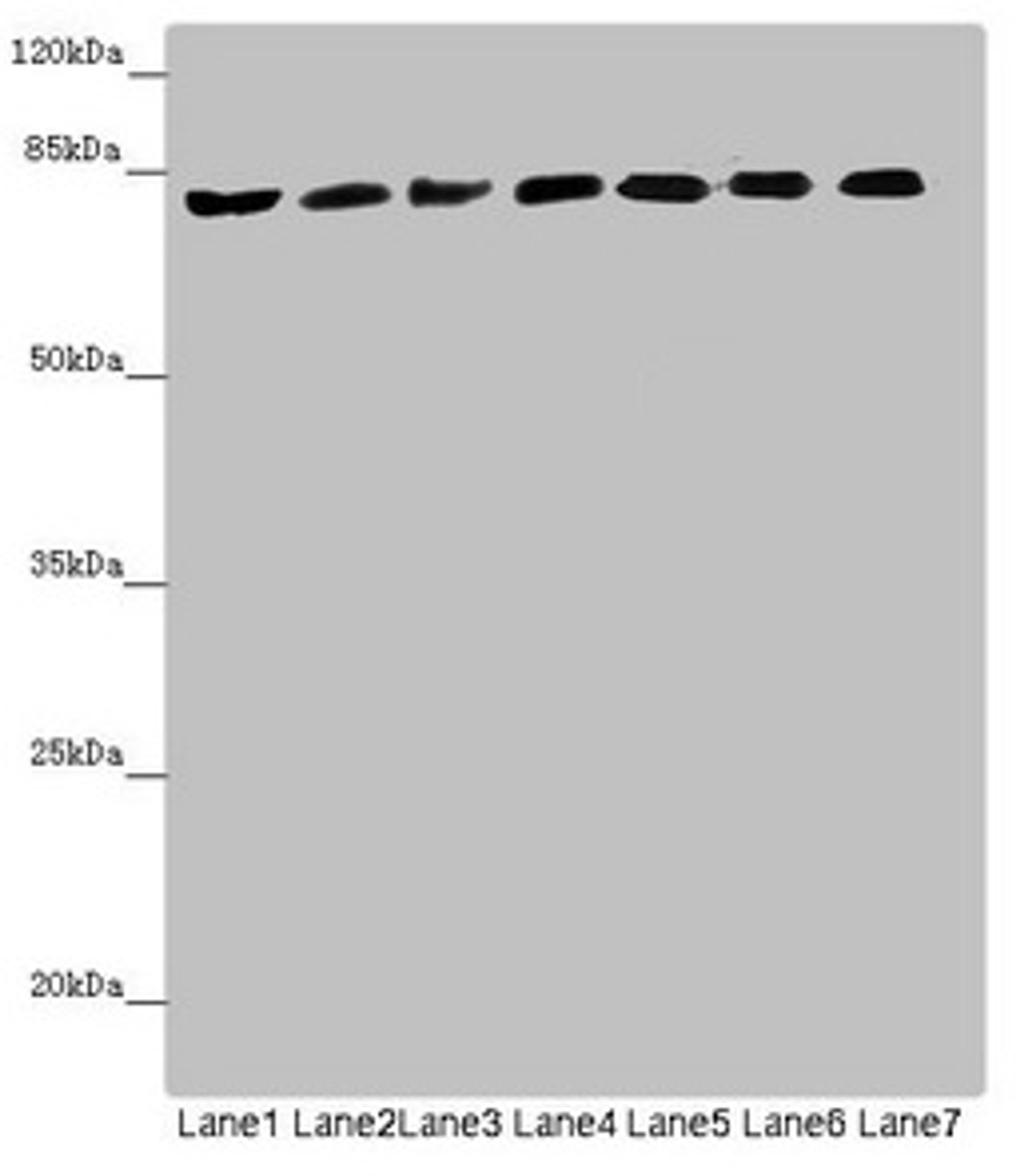 Western blot. All lanes: ACSL6 antibody at 4.64µg/ml. Lane 1: Mouse liver tissue. Lane 2: Mouse heart tissue. Lane 3: Mouse brain tissue. Lane 4: Mouse gonadal tissue. Lane 5: Jurkat whole cell lysate. Lane 6: Raji whole cell lysate. Lane 7: K562 whole cell lysate. Secondary. Goat polyclonal to rabbit IgG at 1/10000 dilution. Predicted band size: 78, 81, 75, 77, 80, 70 kDa. Observed band size: 78 kDa