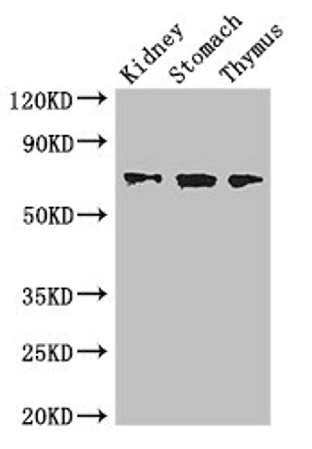 Western Blot. Positive WB detected in: Mouse kidney tissue, Mouse stomach tissue, Mouse thymus tissue. All lanes: COL4A3BP antibody at 3.4ug/ml. Secondary. Goat polyclonal to rabbit IgG at 1/50000 dilution. Predicted band size: 71, 69, 84 kDa. Observed band size: 71 kDa. 