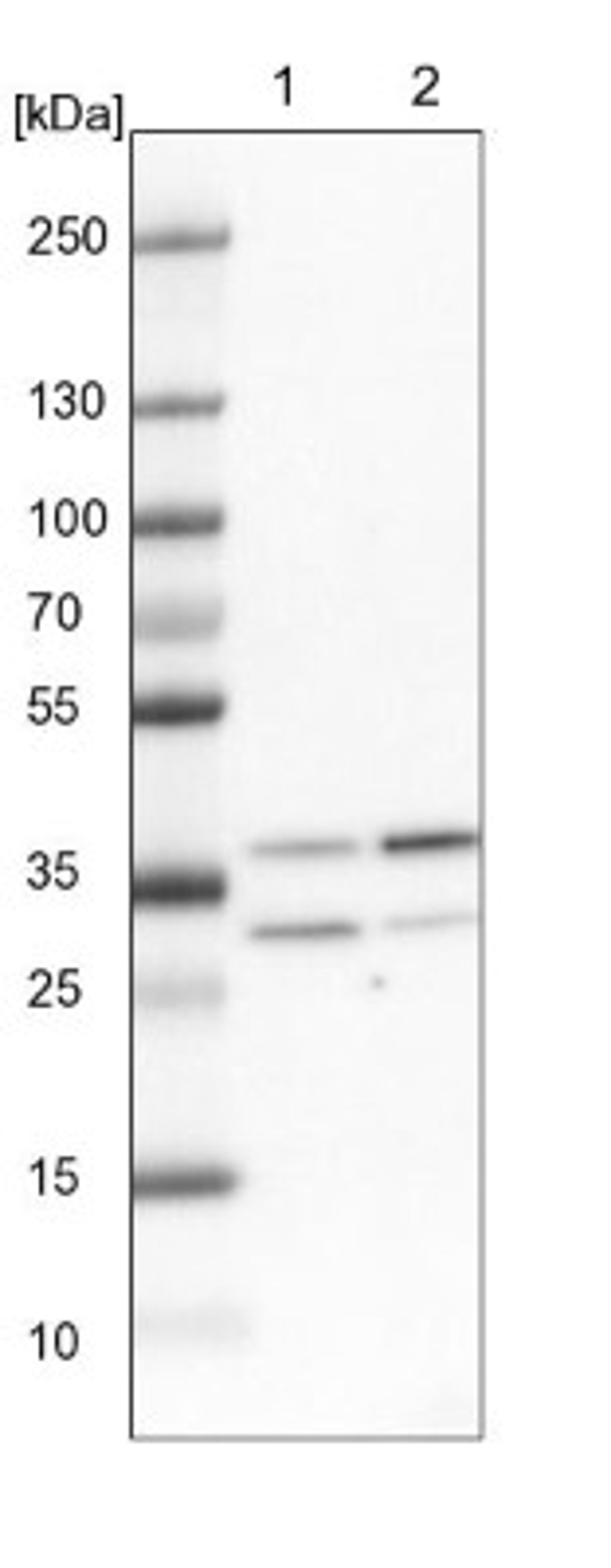 Western Blot: Cdk6 Antibody [NBP1-87262] - Lane 1: NIH-3T3 cell lysate (Mouse embryonic fibroblast cells)<br/>Lane 2: NBT-II cell lysate (Rat Wistar bladder tumour cells)