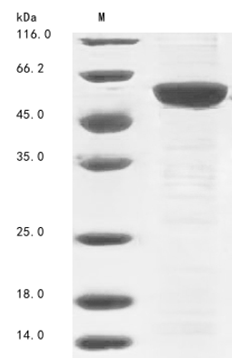 (Tris-Glycine gel) Discontinuous SDS-PAGE (reduced) with 5% enrichment gel and 15% separation gel.