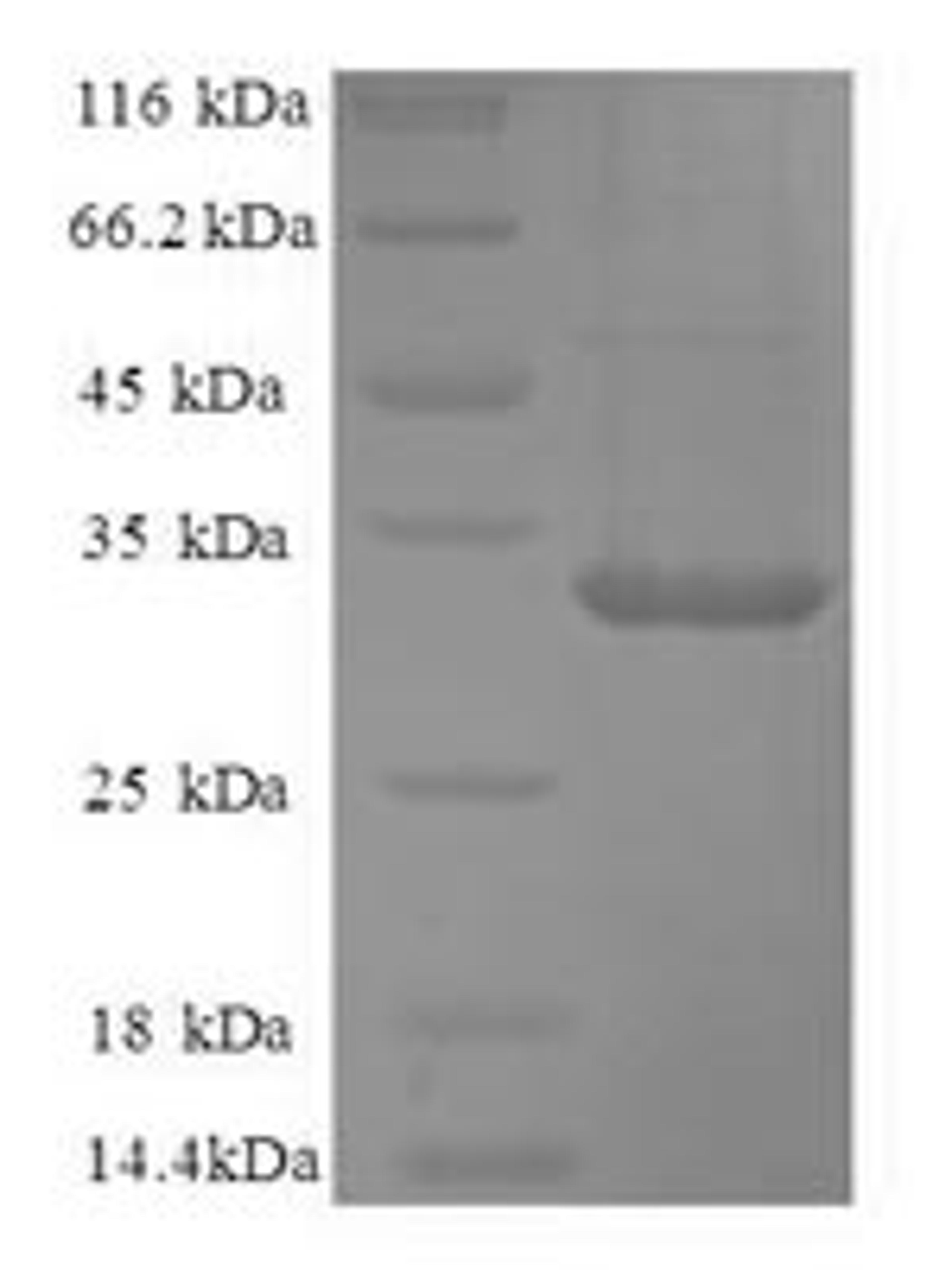 (Tris-Glycine gel) Discontinuous SDS-PAGE (reduced) with 5% enrichment gel and 15% separation gel.