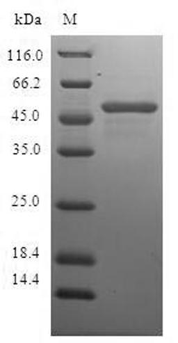 (Tris-Glycine gel) Discontinuous SDS-PAGE (reduced) with 5% enrichment gel and 15% separation gel.