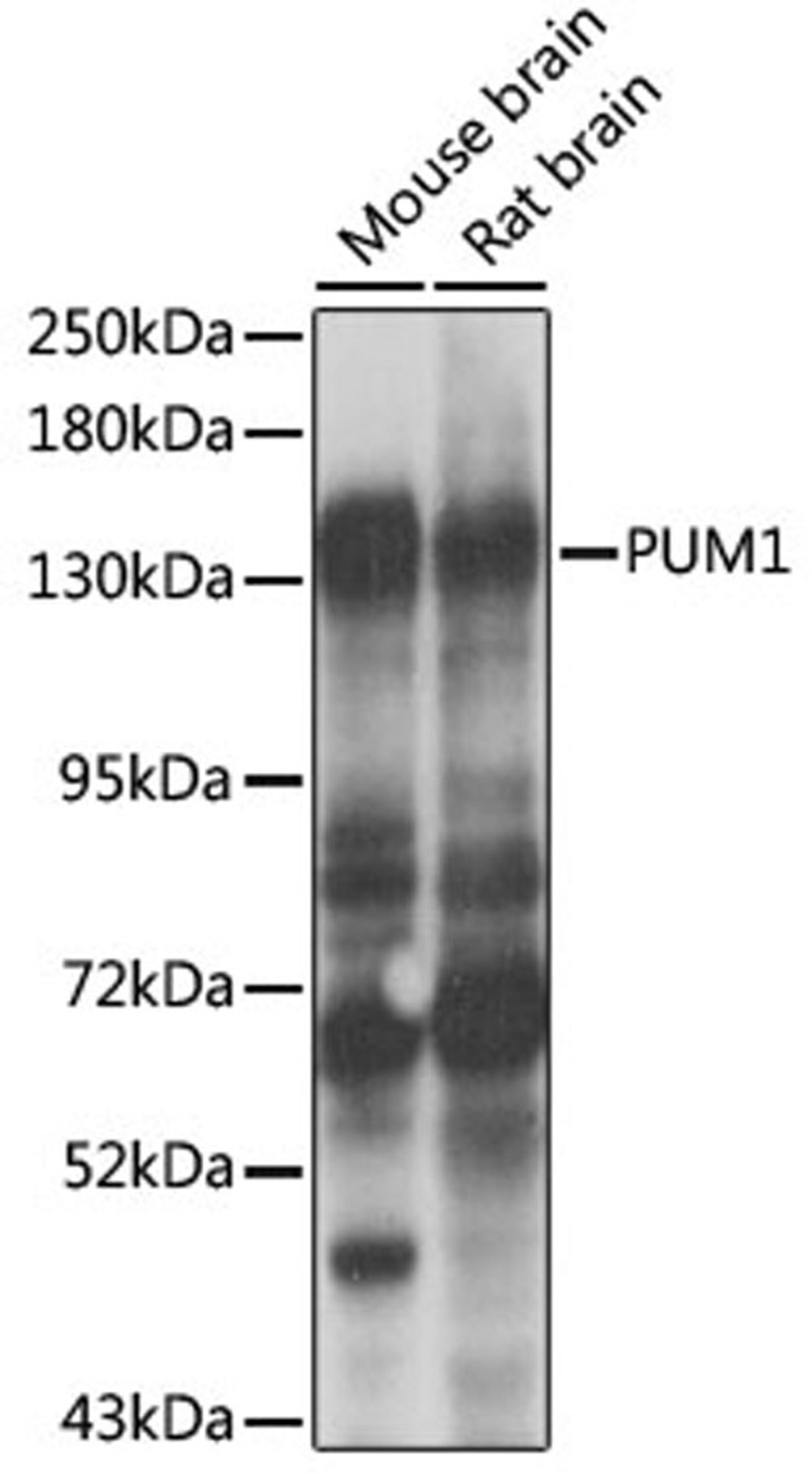 Western blot - PUM1 antibody (A6108)