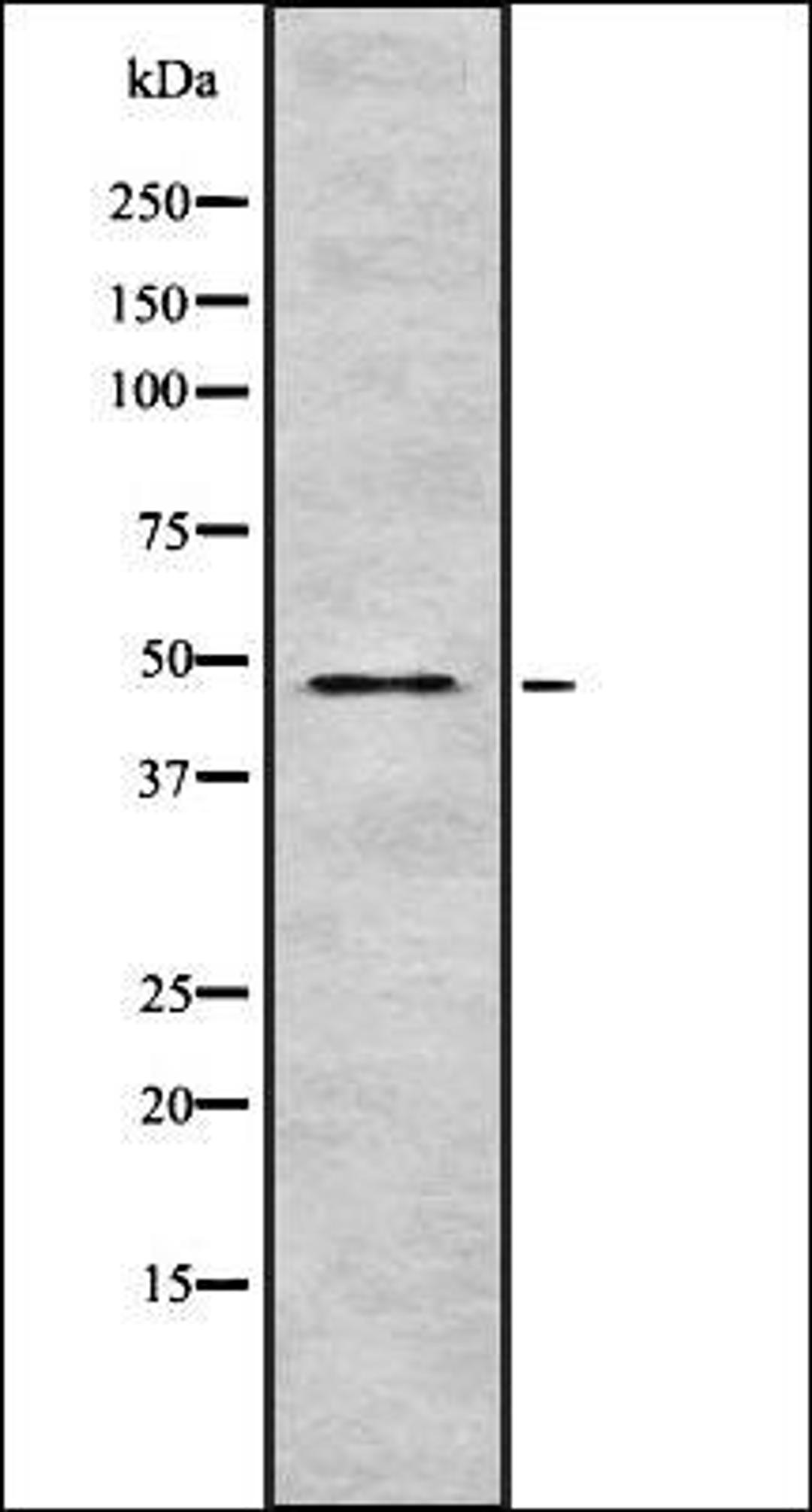 Western blot analysis of HEK293 cells using TRI31 antibody