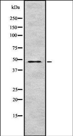 Western blot analysis of HEK293 cells using TRI31 antibody