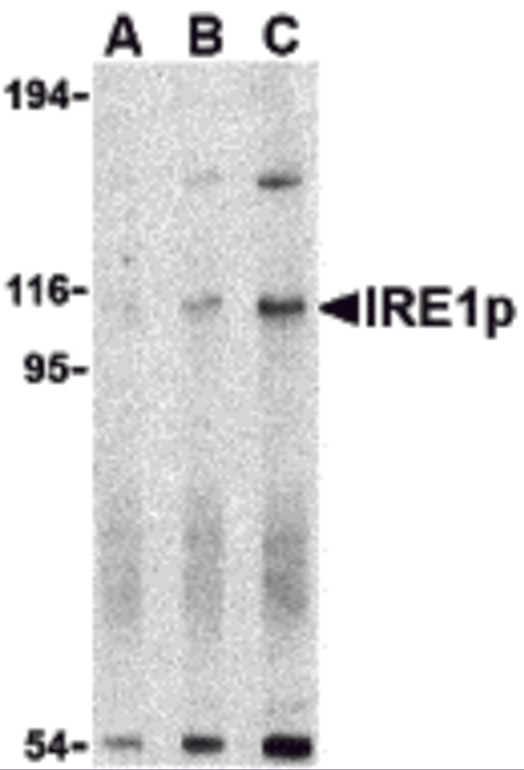 Western blot analysis of IRE1p in A-20 cell lysate with IRE1p antibody at (A) 0.5, (B) 1 and (C) 2 μg/mL.