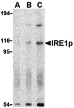 Western blot analysis of IRE1p in A-20 cell lysate with IRE1p antibody at (A) 0.5, (B) 1 and (C) 2 μg/mL.