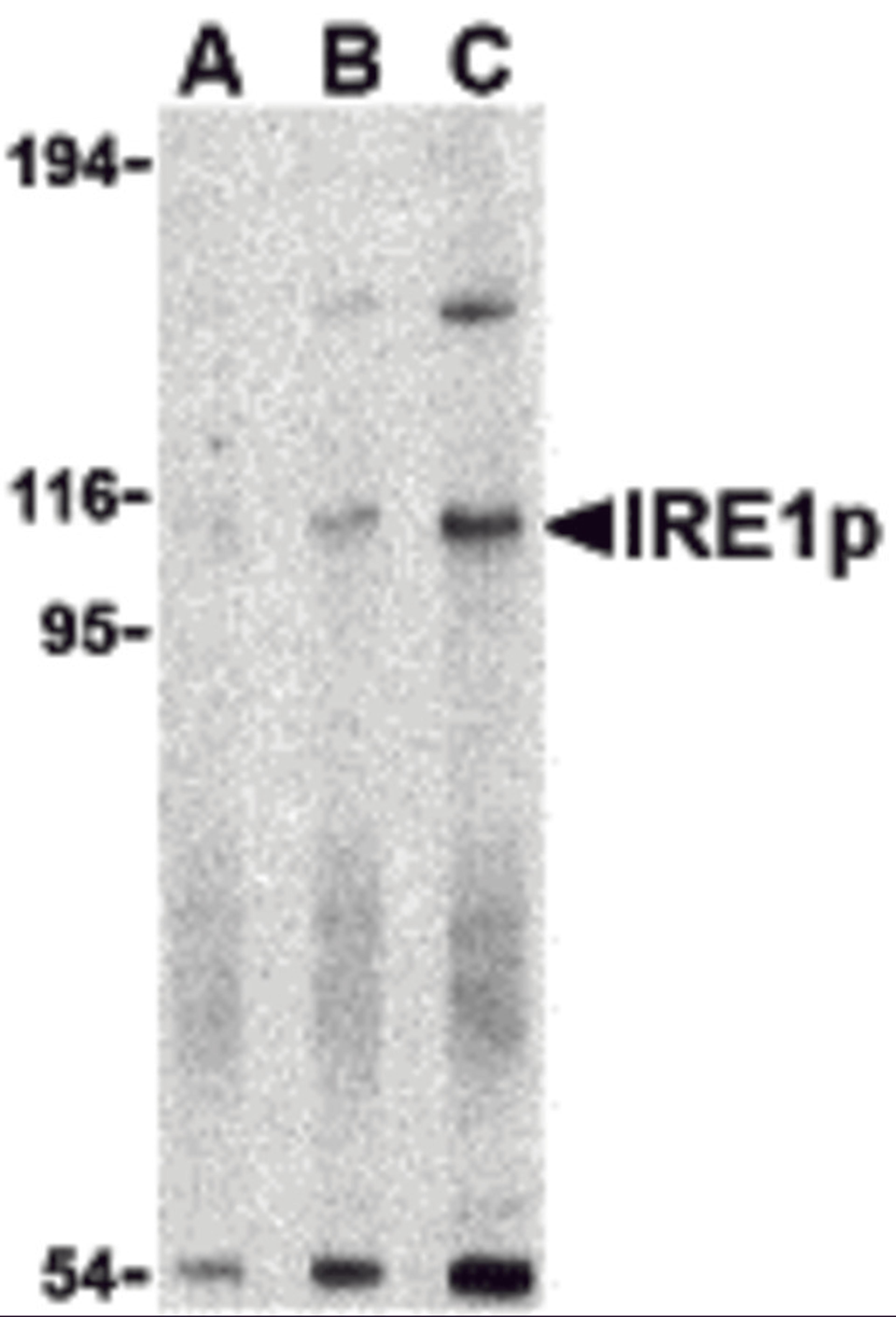 Western blot analysis of IRE1p in A-20 cell lysate with IRE1p antibody at (A) 0.5, (B) 1 and (C) 2 μg/mL.