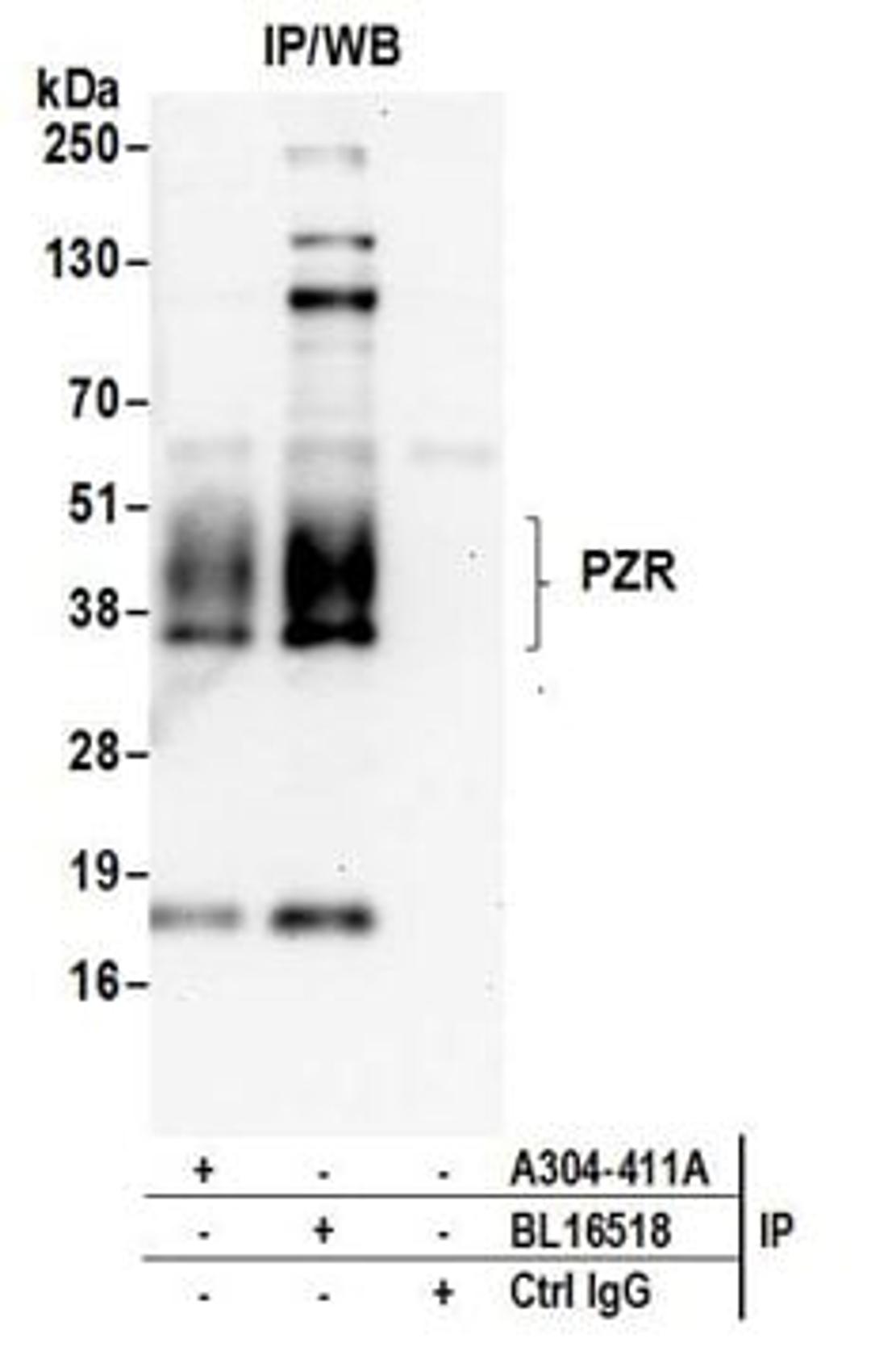 Detection of human PZR by western blot of immunoprecipitates.