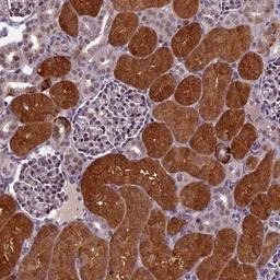 Immunohistochemistry-Paraffin: SV2C Antibody [NBP1-85849] - Staining of human kidney shows strong cytoplasmic positivity in cells in tubules.