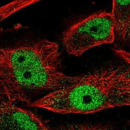 Immunocytochemistry/Immunofluorescence: SPATA4 Antibody [NBP1-80731] - Staining of human cell line U-251MG shows positivity in nuclei but not nucleoli.