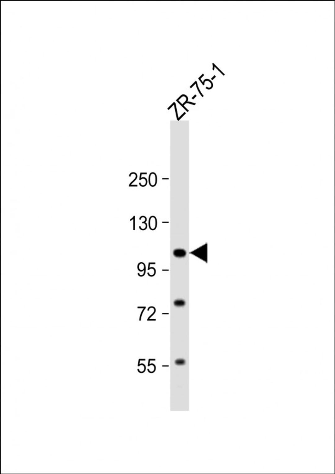 Western Blot at 1:1000 dilution + ZR-75-1 whole cell lysate Lysates/proteins at 20 ug per lane.