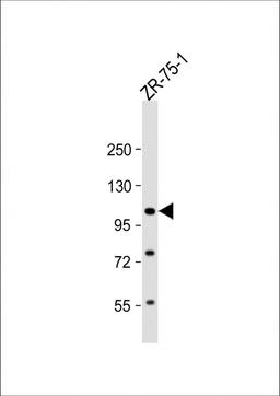 Western Blot at 1:1000 dilution + ZR-75-1 whole cell lysate Lysates/proteins at 20 ug per lane.