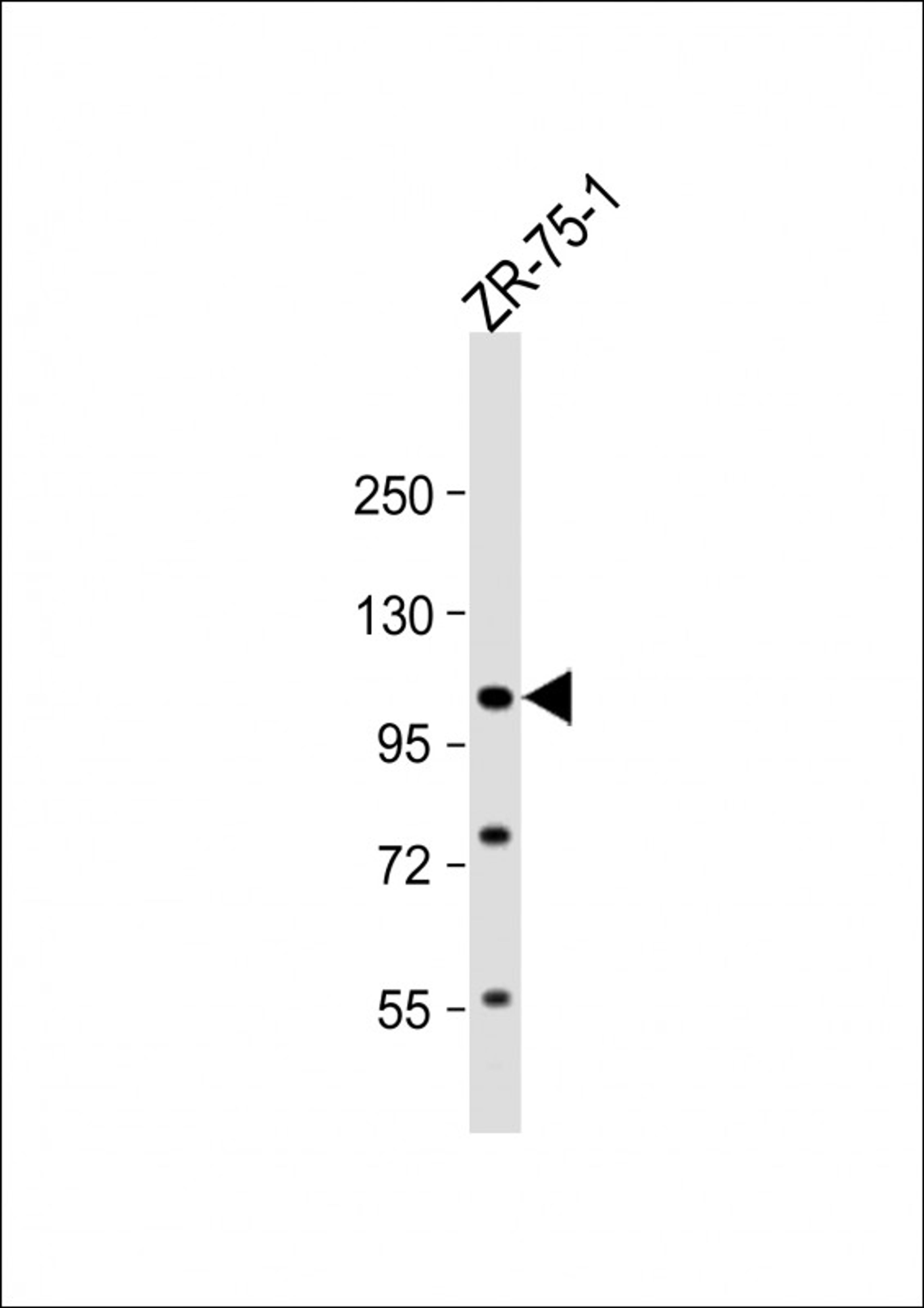 Western Blot at 1:1000 dilution + ZR-75-1 whole cell lysate Lysates/proteins at 20 ug per lane.