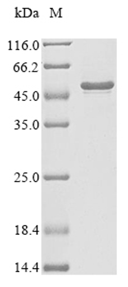(Tris-Glycine gel) Discontinuous SDS-PAGE (reduced) with 5% enrichment gel and 15% separation gel.