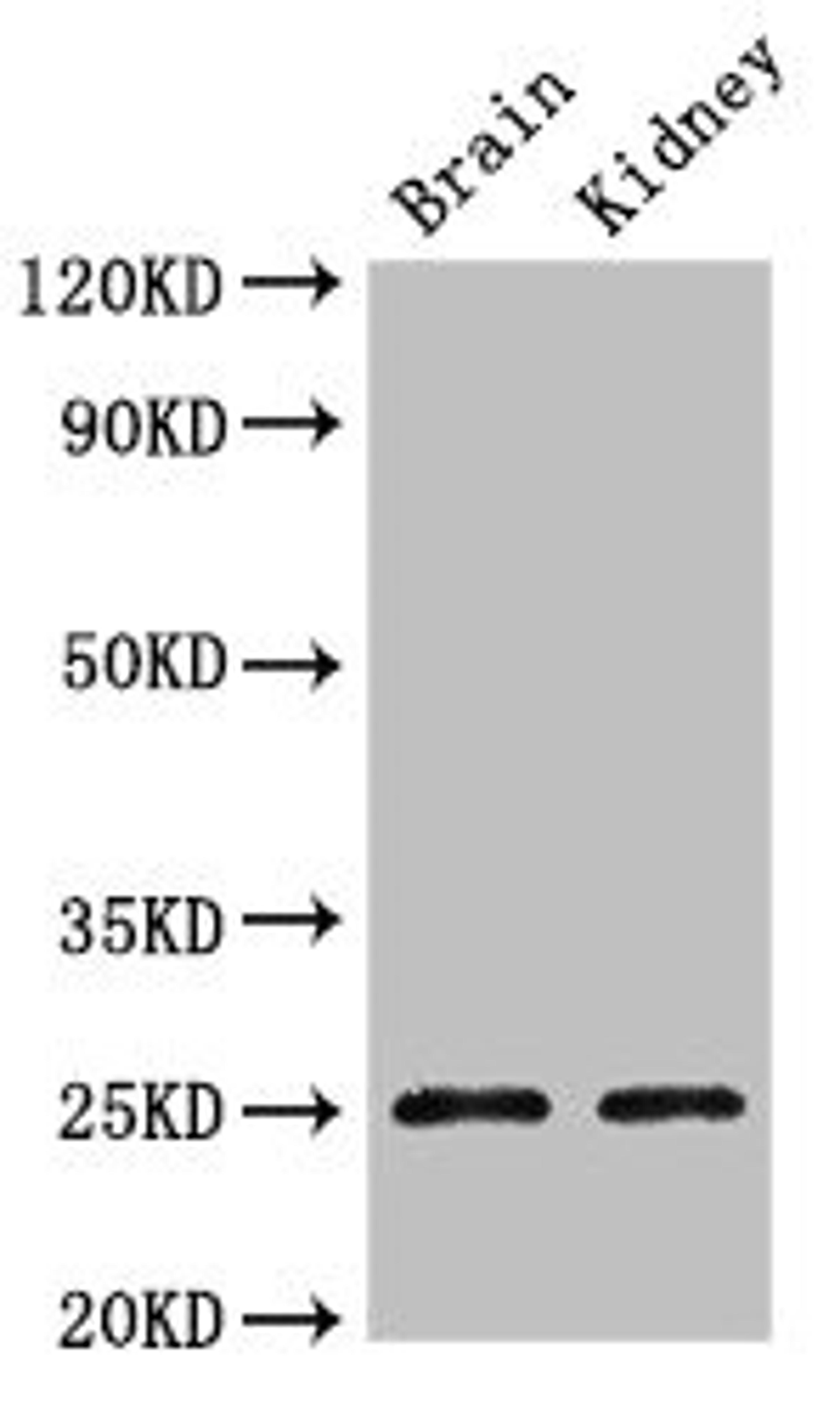 Western Blot. Positive WB detected in: Mouse brain tissue, Mouse kidney tissue. All lanes: CLDN10 antibody at 2.4ug/ml. Secondary. Goat polyclonal to rabbit IgG at 1/50000 dilution. Predicted band size: 25, 23 kDa. Observed band size: 25 kDa.