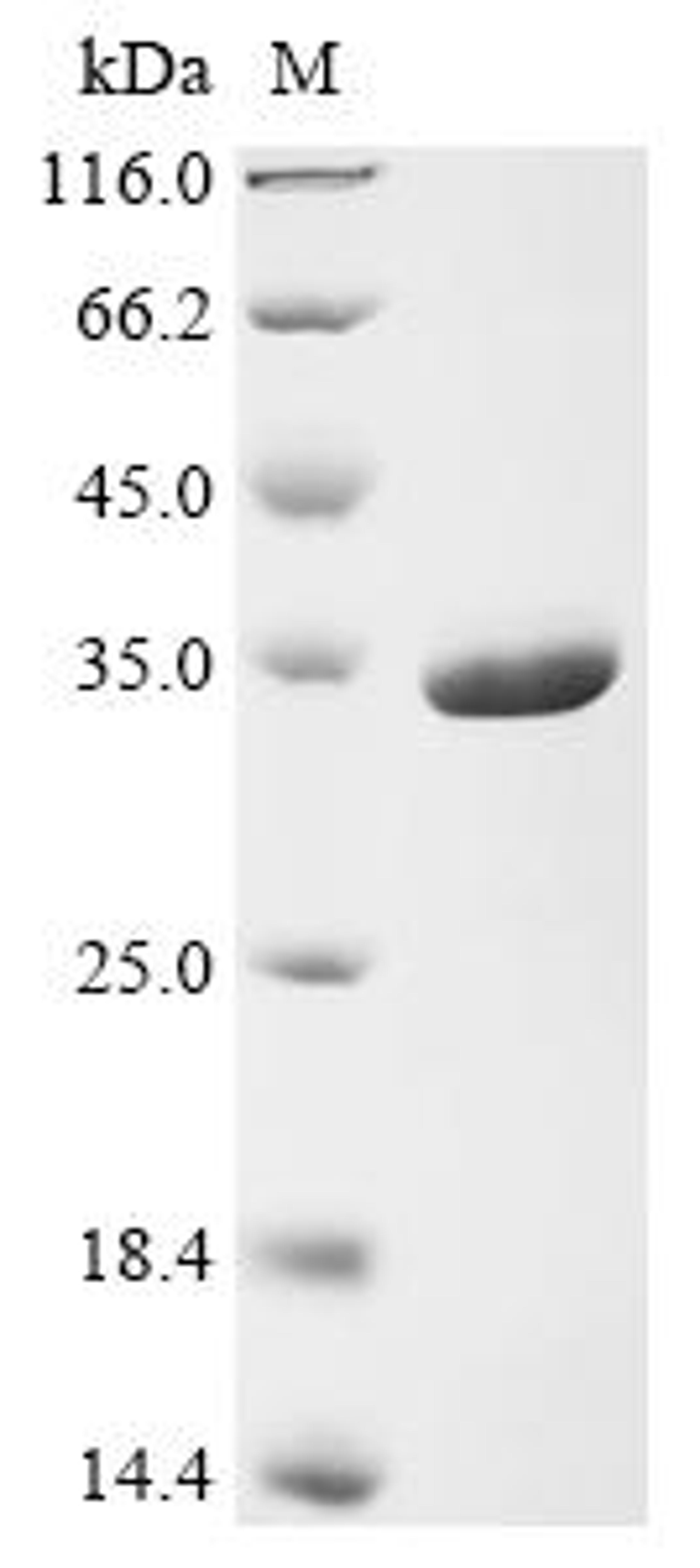 (Tris-Glycine gel) Discontinuous SDS-PAGE (reduced) with 5% enrichment gel and 15% separation gel.