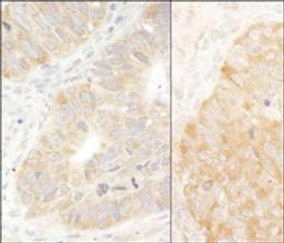 Detection of human and mouse eIF2alpha/EIF2S1 by immunohistochemistry.