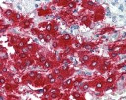 Immunohistochemistry staining of Tyrosine Hydroxylase in adrenal tissue using Tyrosine Hydroxylase Antibody.