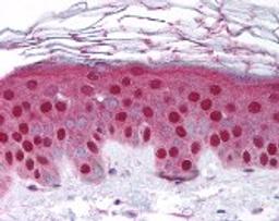 Immunohistochemistry staining of MMP10 in skin tissue using MMP10 Antibody.