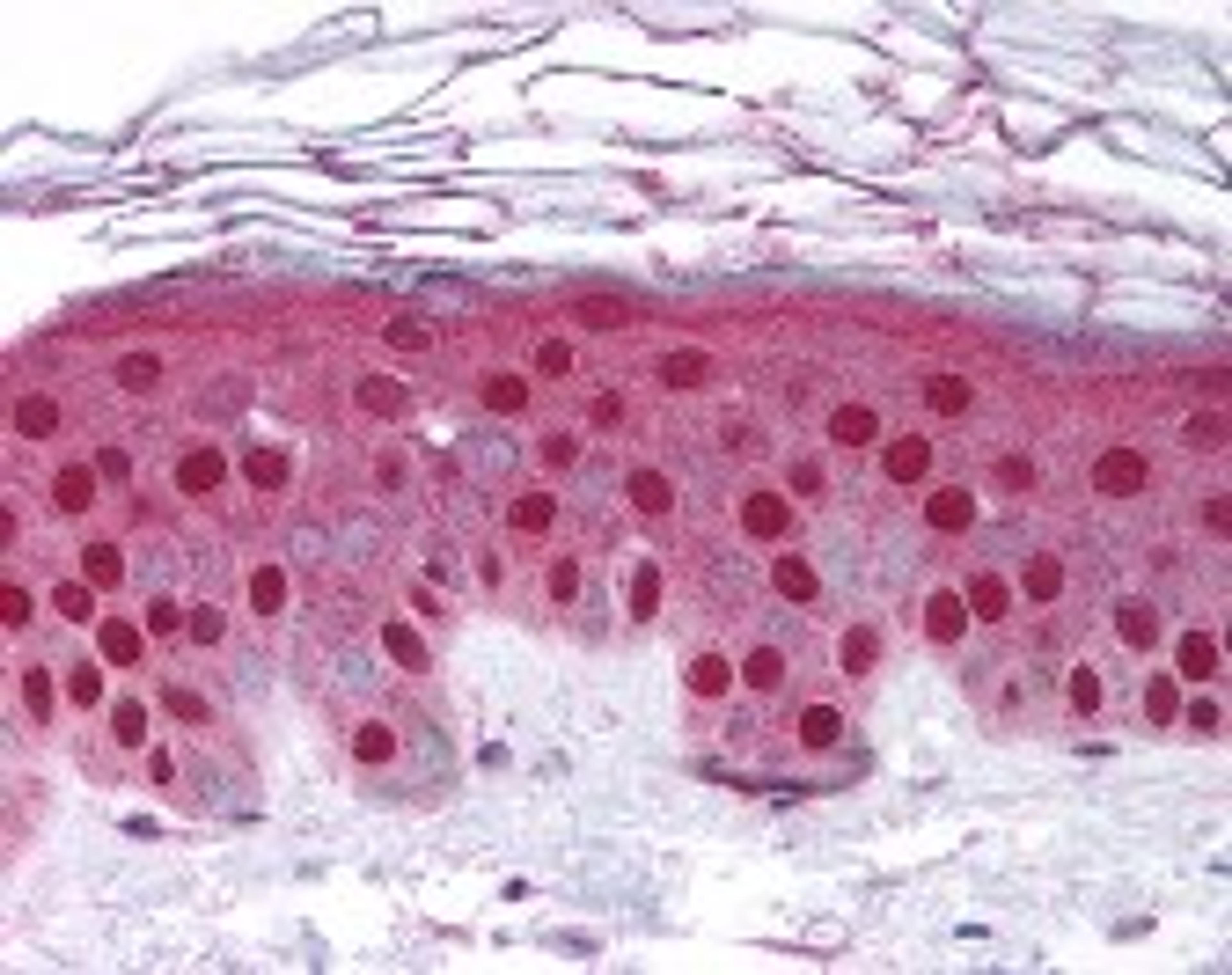 Immunohistochemistry staining of MMP10 in skin tissue using MMP10 Antibody.