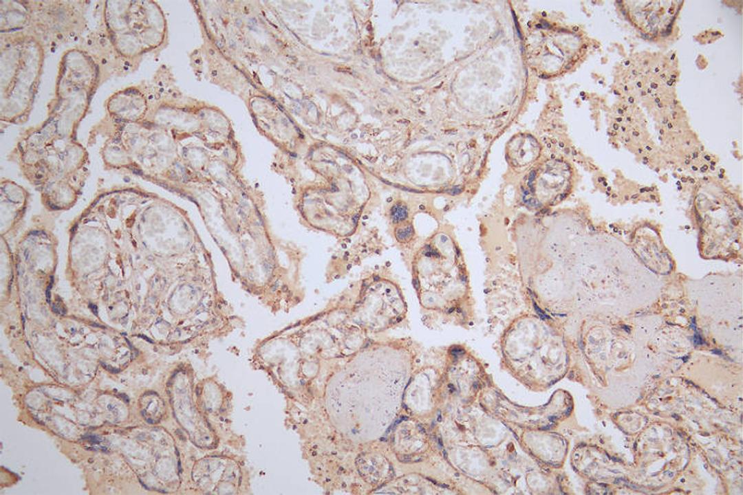 IHC image of CSB-RA566370A0HU diluted at 1:50 and staining in paraffin-embedded human placenta tissue performed on a Leica BondTM system. After dewaxing and hydration, antigen retrieval was mediated by high pressure in a citrate buffer (pH 6.0). Section was blocked with 10% normal goat serum 30min at RT. Then primary antibody (1% BSA) was incubated at 4°C overnight. The primary is detected by a Goat anti-rabbit polymer IgG labeled by HRP and visualized using 0.15% DAB.