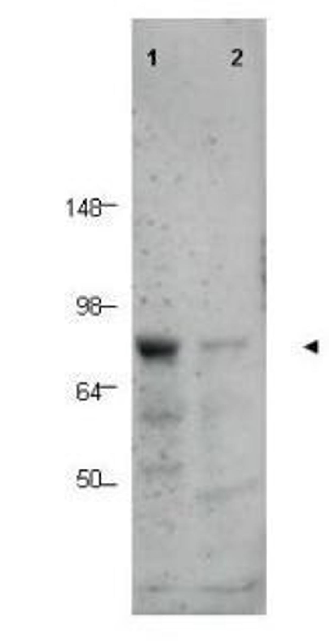 Western blot analysis of human tissue lysates using BORIS antibody