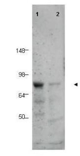 Western blot analysis of human tissue lysates using BORIS antibody