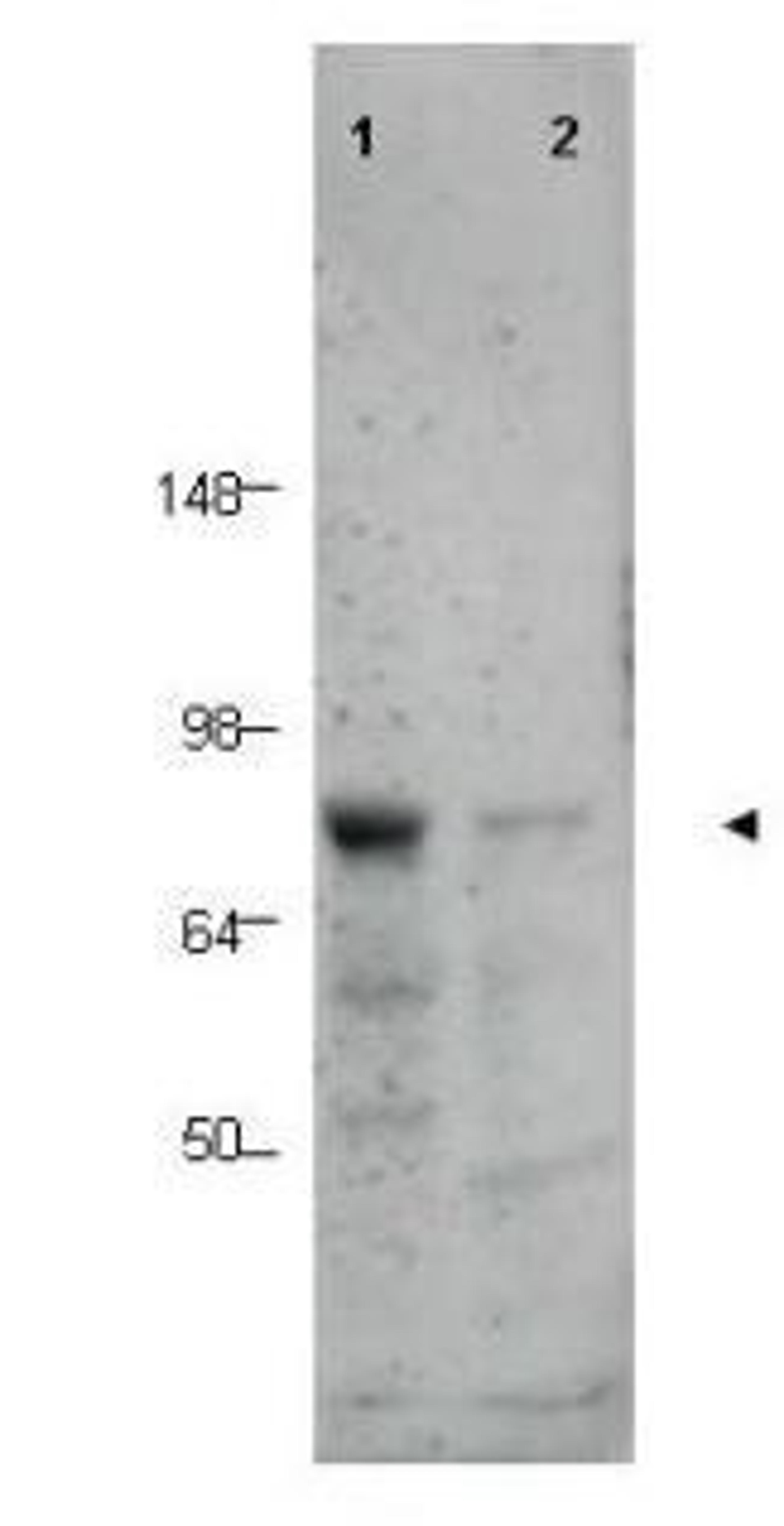 Western blot analysis of human tissue lysates using BORIS antibody