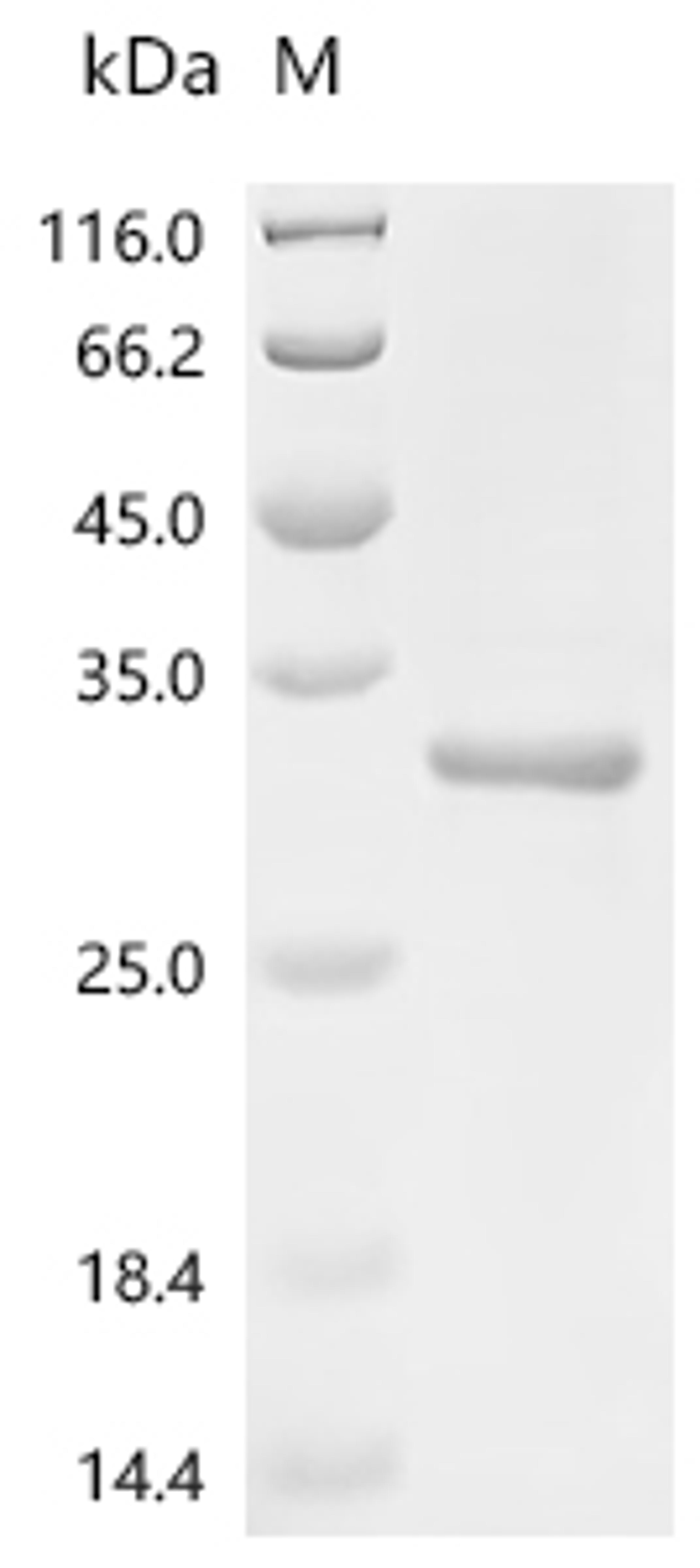 (Tris-Glycine gel) Discontinuous SDS-PAGE (reduced) with 5% enrichment gel and 15% separation gel.